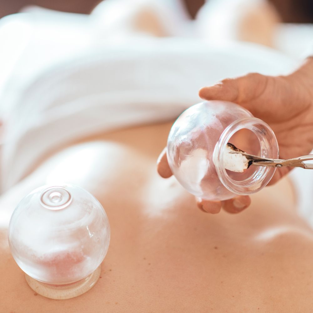 Cupping Massage