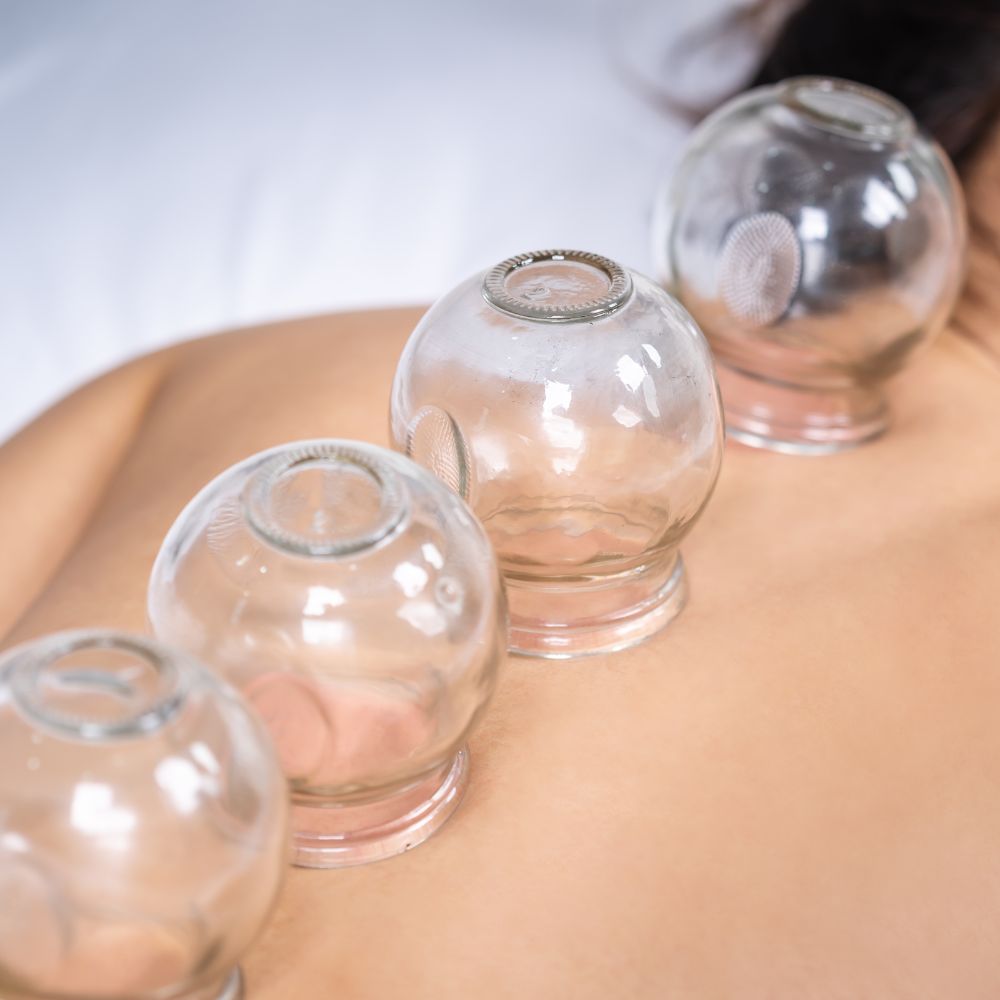 Cupping Massage